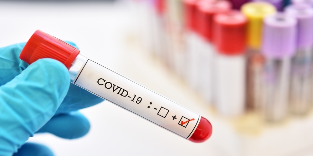 Blood sample tube positive with COVID-19 or novel coronavirus 2019 found in Wuhan, China